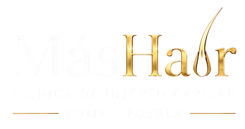 Clinica de Injerto Capilar CMDX y Puebla