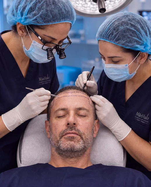 Extracción folicular FUE · MásHair Procedimiento