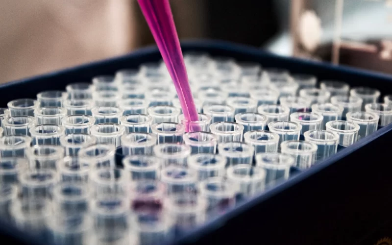 Plasma capilar: qué es y cómo se obtiene el plasma rico en plaquetas