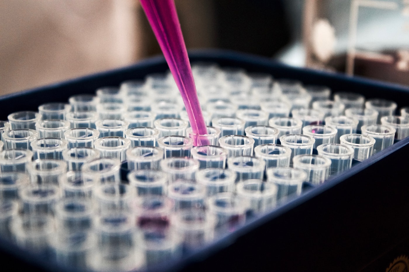 Aplicación de plasma capilar mediante microinfiltraciones en el cuero cabelludo