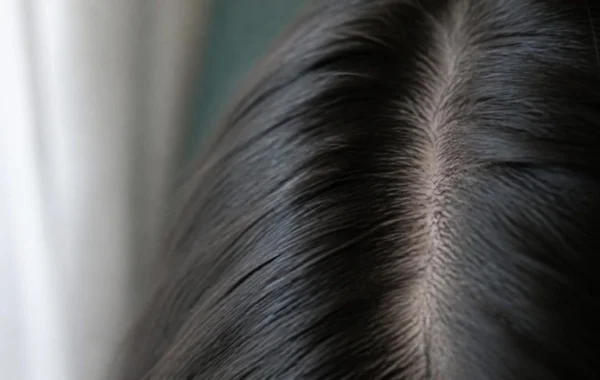 Caída de cabello en mujeres: por qué se estudia distinto